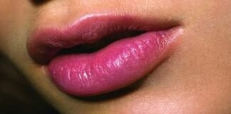 naturallookinglipenhancement_lipplumpingtreatment1