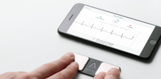AliveCor